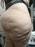 Fat Fetish Exorthiccx 10vv7qk 2