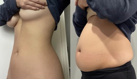 bigger Softiebelly 10k42kp