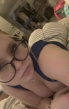 bigger Swellingcowww 1iertq5 1
