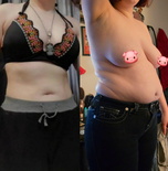 wgbeforeafter Altballinout 1jxqzzo