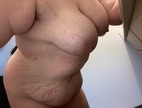 wgbeforeafter DELETED 1fi2ffd 2