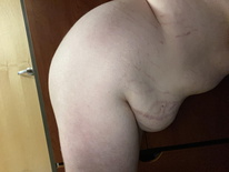 wgbeforeafter DELETED 1fi2ffd 4
