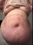 wgbeforeafter Extreme-Tooth-1043 1jmnir9 2