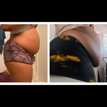 wgbeforeafter GrowingBbyGirl 1iosxh4