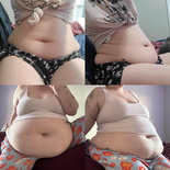 wgbeforeafter Plumpmeup6224 1jagjyq