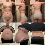 wgbeforeafter Plumpmeup6224 1jc9vbc
