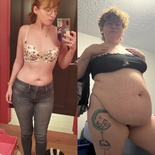 wgbeforeafter Plumpmeup6224 1kbvuvh