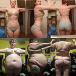 wgbeforeafter Plumpmeup6224 1keksxv
