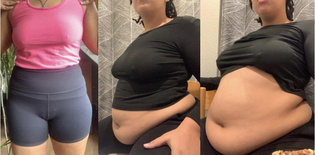 wgbeforeafter Regalkapha 103snhi