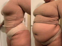wgbeforeafter Regalkapha 10uo4z5