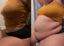 wgbeforeafter Regalkapha 1137nt6