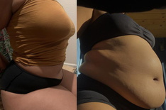 wgbeforeafter Regalkapha zwygzn