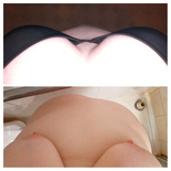 wgbeforeafter SkinnyStranger1666 1jl3qzd