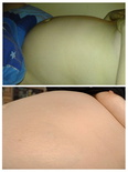 wgbeforeafter SkinnyStranger1666 1jv7dlv 2