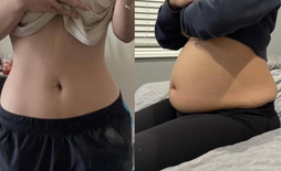 wgbeforeafter Softiebelly 10nwq1u