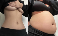 wgbeforeafter Softiebelly 10q96tm