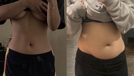 wgbeforeafter Softiebelly 10xxxmd