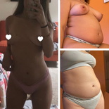 wgbeforeafter babychubs21 k14ir4