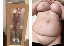 wgbeforeafter chunkynymph 13ljf0p