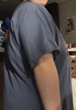 wgbeforeafter cutefeetcora 1i2fhqc 1