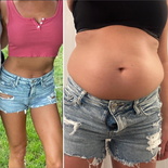 wgbeforeafter fitbellybaby1 19asz3m 1