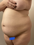 wgbeforeafter h0bbitwife y8nbml 2