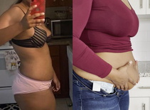wgbeforeafter lusciouskimi 1kbqnrl 1
