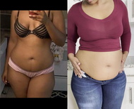 wgbeforeafter lusciouskimi 1kbqnrl 3