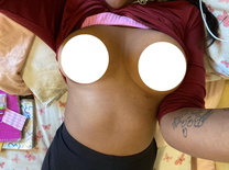 wgbeforeafter nontoxicfun 1k3rgzb 2