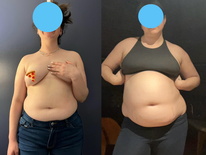 wgbeforeafter spanksofamerica 1ij9zlx 1