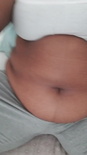 Belly bloat rub
