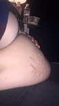153502799975 stretch marks galore ive been feeling 3