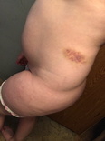 173781861423 baby got a bruise and a booty 4