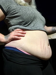 176216526941 she has the sexiest stretch marks ive 2
