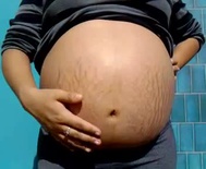 Fully loaded belly with fully loaded stretch marks