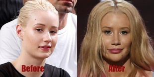 iggy-before-after-876